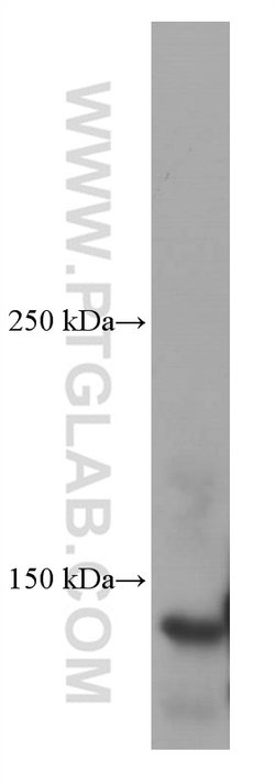 Ceruloplasmin Mouse anti-Human, Rat, Clone: 3C8A5, Proteintech:Antibodies:Primary