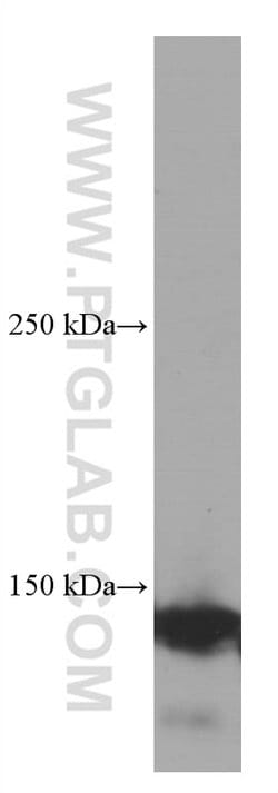 Ceruloplasmin Mouse anti-Human, Rat, Clone: 3C8A5, Proteintech:Antibodies:Primary