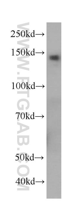 Ceruloplasmin Mouse anti-Human, Rat, Clone: 3C8A5, Proteintech:Antibodies:Primary