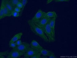 C3/C3b/C3c Mouse anti-Human, Clone: 2A6B3, Proteintech:Antibodies:Primary