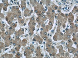 C3/C3b/C3c Mouse anti-Human, Clone: 2A6B3, Proteintech:Antibodies:Primary
