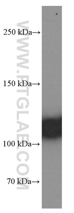 C3/C3b/C3c Mouse anti-Human, Clone: 2A6B3, Proteintech:Antibodies:Primary