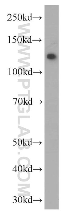 C3/C3b/C3c Mouse anti-Human, Clone: 2A6B3, Proteintech:Antibodies:Primary