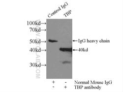 150UL TBP Mouse Monoclonal antibody