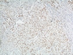 TBP Mouse anti-Human, Mouse, Porcine, Rat, Clone: 2H3B2, Proteintech 150