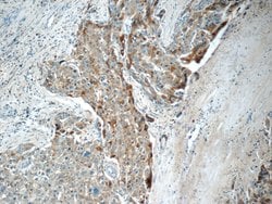 LBP Mouse anti-Human, Clone: 3A7E3, Proteintech 150 &mu;L; Unconjugated:Antibodies,