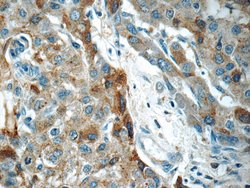 LBP Mouse anti-Human, Clone: 3A7E3, Proteintech 150 &mu;L; Unconjugated:Antibodies,
