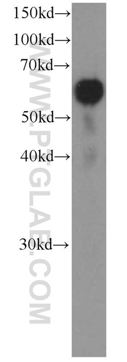 LBP Mouse anti-Human, Clone: 3A7E3, Proteintech 150 &mu;L; Unconjugated:Antibodies,
