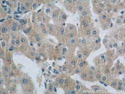 LBP Mouse anti-Human, Clone: 3A7E3, Proteintech 150 &mu;L; Unconjugated:Antibodies,