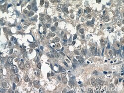 SMARCE1 Mouse anti-Human, Clone: 1F3D6, Proteintech 150 &mu;L; Unconjugated:Antibodies,