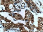 Thumbnail_HSP70 Mouse anti-Human, Mouse, Rat, Yeast, Clone: 4E7E5, Proteintech 150