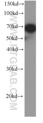 Thumbnail_HSP70 Mouse anti-Human, Mouse, Rat, Yeast, Clone: 4E7E5, Proteintech 150