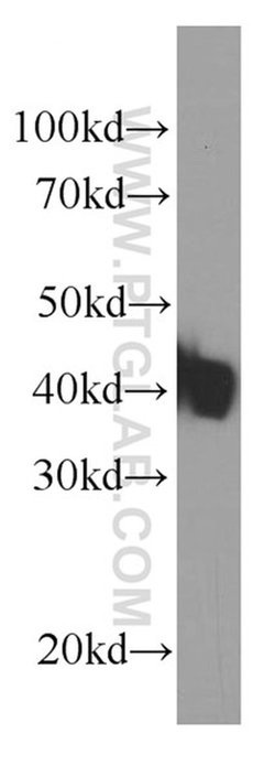 KLF15 Mouse anti-Human, Clone: 2B8G9, Proteintech:Antibodies:Primary Antibodies