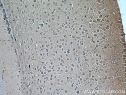 SEPT8 Mouse anti-Human, Clone: 4A12G9, Proteintech 150 &mu;L; Unconjugated:Antibodies,