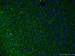 acetylated Tubulin(Lys40) Mouse anti-Canine, Human, Mouse, Porcine, Rat,