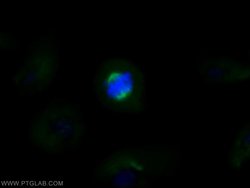 acetylated Tubulin(Lys40) Mouse anti-Canine, Human, Mouse, Porcine, Rat,