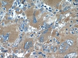 acetylated Tubulin(Lys40) Mouse anti-Canine, Human, Mouse, Porcine, Rat,