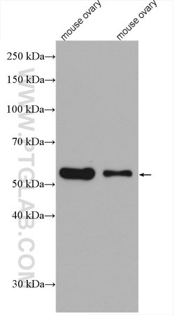acetylated Tubulin(Lys40) Mouse anti-Canine, Human, Mouse, Porcine, Rat,