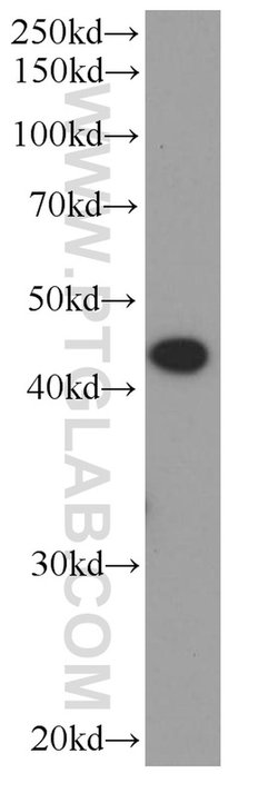 ST6GALNAC6 Mouse anti-Human, Mouse, Clone: 1A7B7, Proteintech 20 &mu;L;