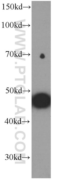 MYOD1 Mouse anti-Human, Clone: 5D1D12, Proteintech:Antibodies:Primary Antibodies