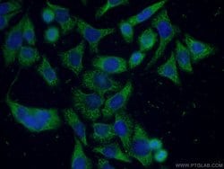 APOD Mouse anti-Human, Clone: 1C6D10, Proteintech 150 &mu;L; Unconjugated:Antibodies,