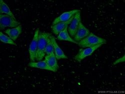 ORM2 Mouse anti-Human, Clone: 4E9H10, Proteintech:Antibodies:Primary Antibodies