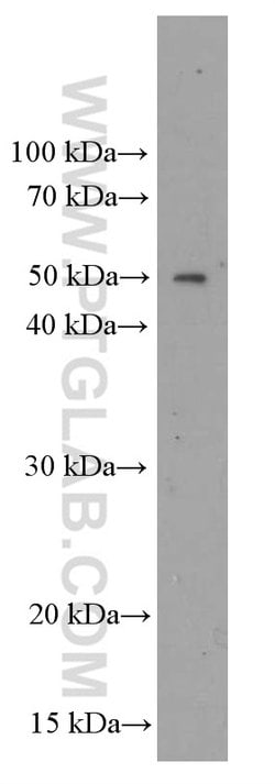 ORM2 Mouse anti-Human, Clone: 4E9H10, Proteintech:Antibodies:Primary Antibodies