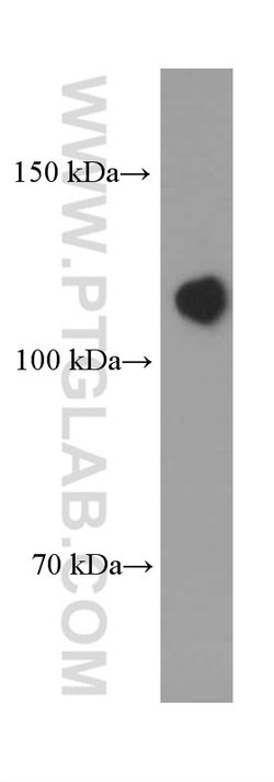 N-cadherin Mouse anti-Human, Mouse, Porcine, Rat, Clone: 1D8B3, Proteintech:Antibodies:Primary