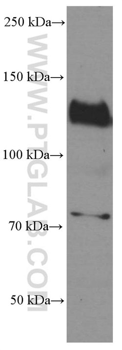 N-cadherin Mouse anti-Human, Mouse, Porcine, Rat, Clone: 1D8B3, Proteintech:Antibodies:Primary