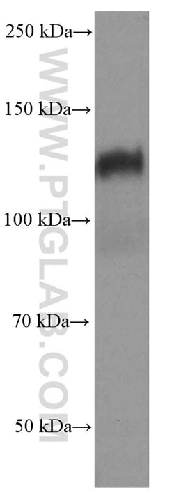 N-cadherin Mouse anti-Human, Mouse, Porcine, Rat, Clone: 1D8B3, Proteintech:Antibodies:Primary