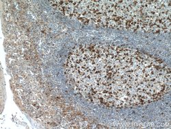 PD-1/CD279 Mouse anti-Human, Mouse, Rat, Clone: 4H4D1, Proteintech 150