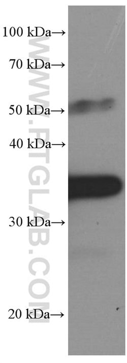 PD-1/CD279 Mouse anti-Human, Mouse, Rat, Clone: 4H4D1, Proteintech 150