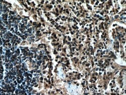 PD-1/CD279 Mouse anti-Human, Mouse, Rat, Clone: 4H4D1, Proteintech 150