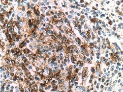 PD-1/CD279 Mouse anti-Human, Mouse, Rat, Clone: 4H4D1, Proteintech 150