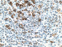 PD-1/CD279 Mouse anti-Human, Mouse, Rat, Clone: 4H4D1, Proteintech 150