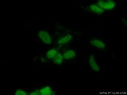 CHD4 Mouse anti-Human, Clone: 3D9G2, Proteintech 150 &mu;L; Unconjugated:Antibodies,