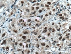 CHD4 Mouse anti-Human, Clone: 3D9G2, Proteintech 150 &mu;L; Unconjugated:Antibodies,