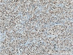 CHD4 Mouse anti-Human, Clone: 3D9G2, Proteintech 150 &mu;L; Unconjugated:Antibodies,