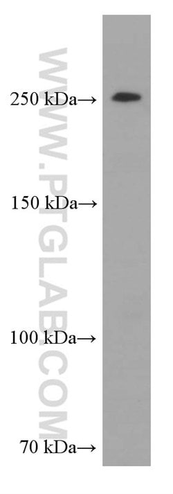 CHD4 Mouse anti-Human, Clone: 3D9G2, Proteintech 150 &mu;L; Unconjugated:Antibodies,