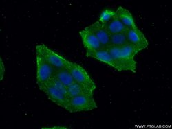 MALT1 Mouse anti-Human, Clone: 4D3F6, Proteintech 150 &mu;L; Unconjugated:Antibodies,