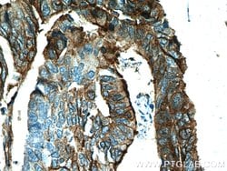 S100A10 Mouse anti-Human, Clone: 1B3F9, Proteintech 150 &mu;L; Unconjugated:Antibodies,