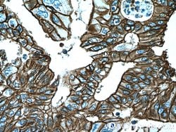 S100A10 Mouse anti-Human, Clone: 1B3F9, Proteintech 150 &mu;L; Unconjugated:Antibodies,