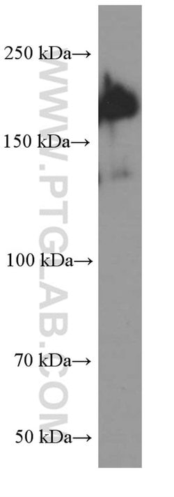 SALL4 Mouse anti-Human, Clone: 2B5B2, Proteintech:Antibodies:Primary Antibodies