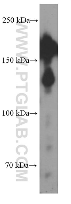 SALL4 Mouse anti-Human, Clone: 2B5B2, Proteintech:Antibodies:Primary Antibodies