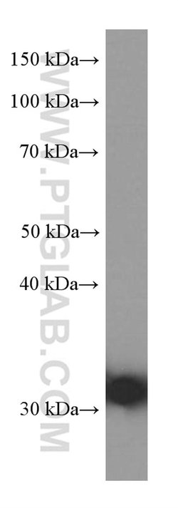 C4 gamma chain Mouse anti-Human, Clone: 2G6A7, Proteintech 20 &mu;L; Unconjugated:Antibodies,