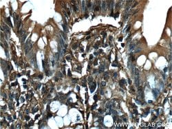 Annexin V Mouse anti-Human, Mouse, Clone: 1E6A8, Proteintech:Antikörper:Primärantikörper
