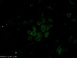 IMP3 Mouse anti-Human, Clone: 1E7D6, Proteintech 20 &mu;L | Buy Online | Proteintech | Fisher Scientific