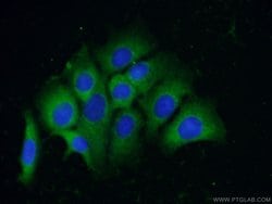 TRIM44 Mouse anti-Human, Clone: 1B12H12, Proteintech:Antibodies:Primary