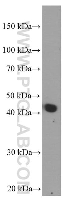 APOA4 Mouse anti-Human, Clone: 3A9A8, Proteintech:Antibodies:Primary Antibodies
