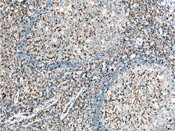 CD11a/Integrin alpha-L Mouse anti-Human, Clone: 1E3H12, Proteintech 150